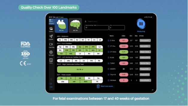 Fetoly AI ultrasound software interface showing anatomical landmark analysis